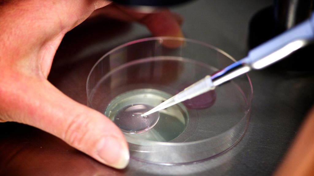 Insights into 27 Years of IVF Treatments in the U.K.