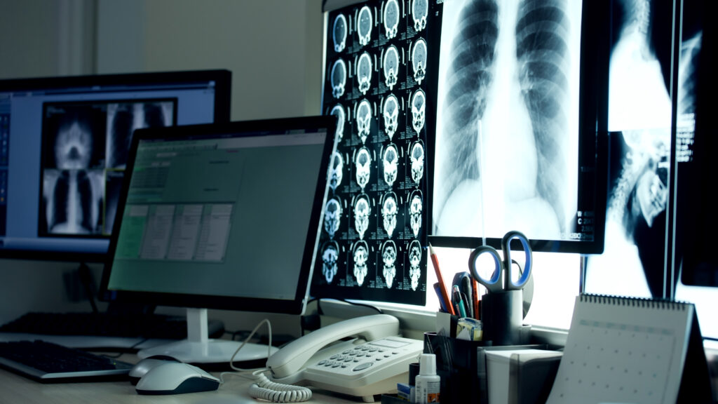 Berkeley-Spun AI Startup Aims to Accelerate and Enhance Radiology with Advanced Image Analysis