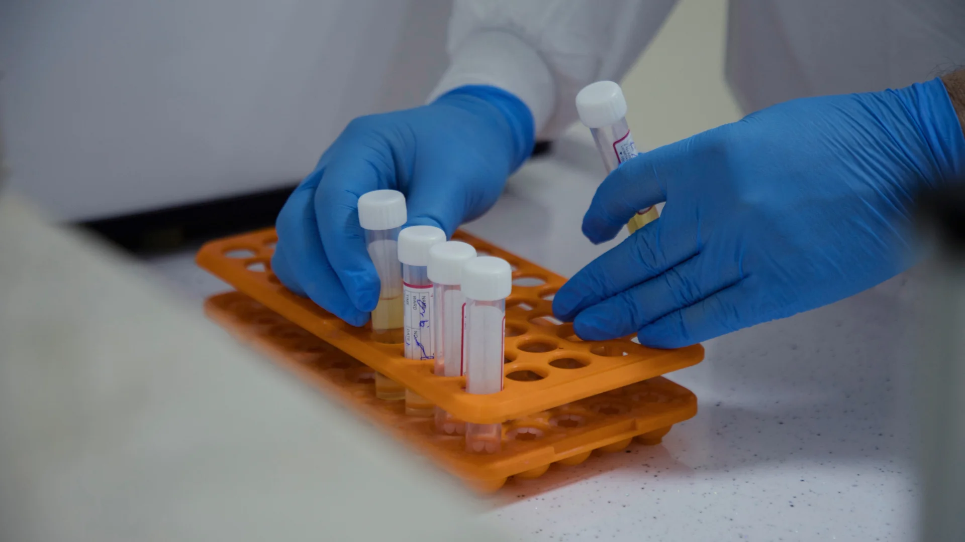 NewLimit Raises $435 Million to Develop Cellular Aging Reversal Therapy